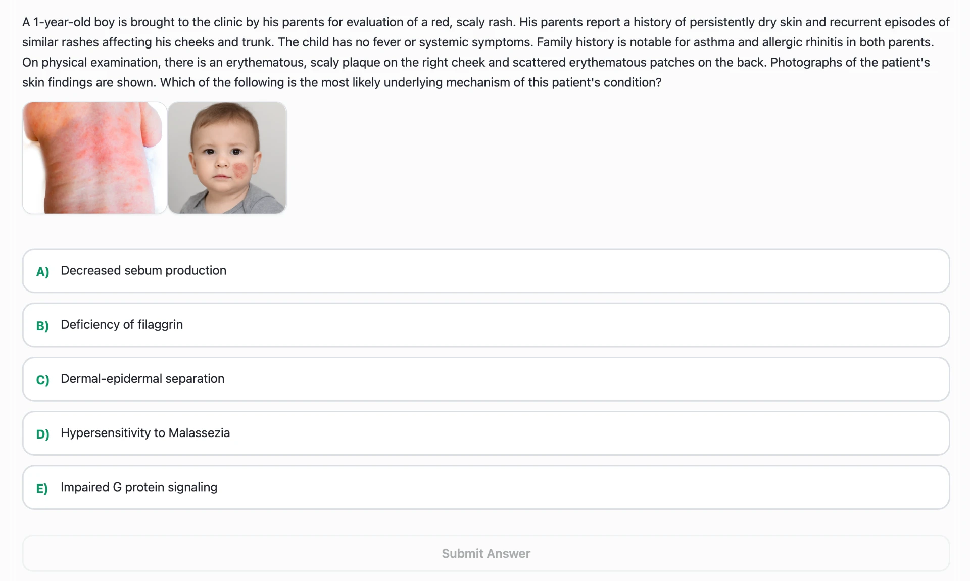 Questão clínica do ProMD Qbank com imagem de dermatite atópica infantil e opções de resposta