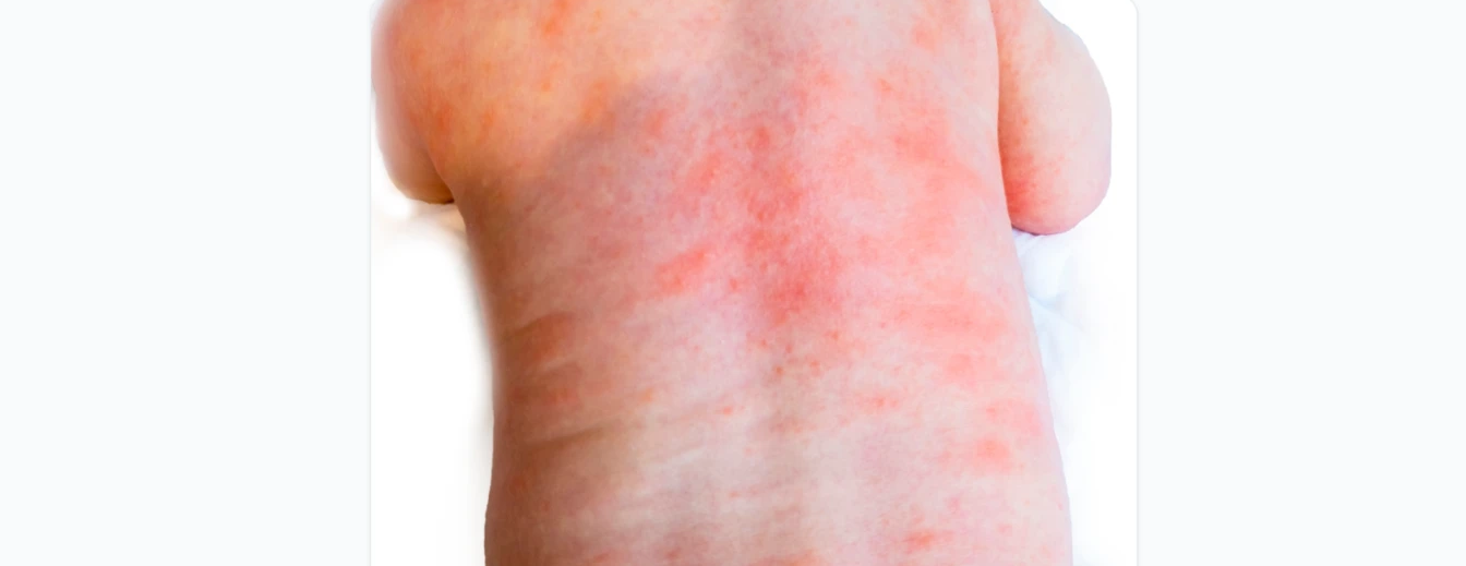 ProMD Qbank clinical lesion detail